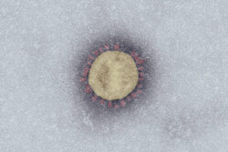 SARS-Coronavirus-2 (SARS-CoV-2, Isolat SARS-CoV-2/Italy-INMI1). Elektronenmikroskopie, Negativkontrastierung (PTA). Maßstab: 100 nm. Quelle: Tobias Hoffmann, Michael Laue, Robert Koch-Institut (RKI), 2020.SARS-Coronavirus-2 (SARS-CoV-2, Isolate SARS-CoV-2/Italy-INMI1). Negative staining electron microscopy, PTA staining. Scale bar: 100 nm. Source: Tobias Hoffmann, Michael Laue, Robert Koch Institute (RKI), 2020.Quelldatei: #6532_04_SARS-CoV-2_DOG_PTA_CCD_33.tif